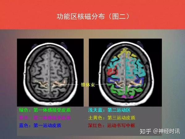 脑功能区及解剖学定位看到了你要记得收藏转发