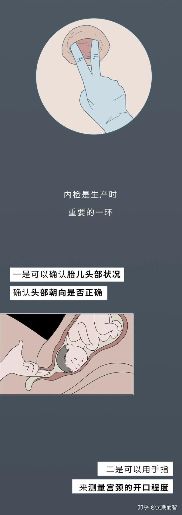 一张图带你了解骨开十指和腹缝七层是咋回事