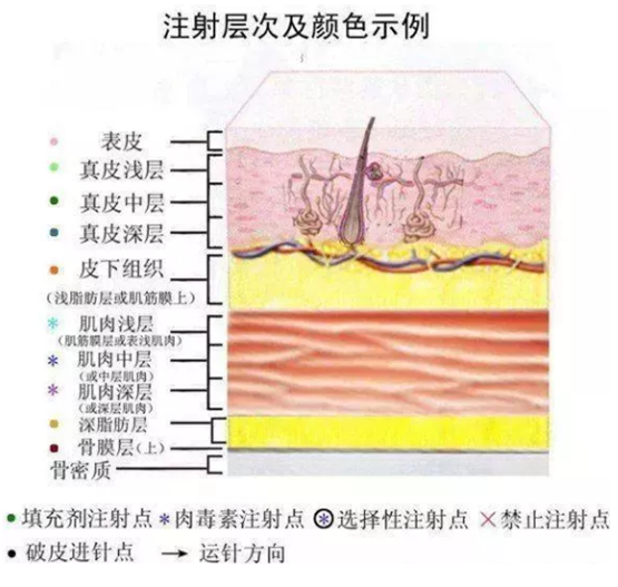 其次,是捏鼻子的技术,玻尿酸注射会不会立刻定型,需要由医生捏出合适