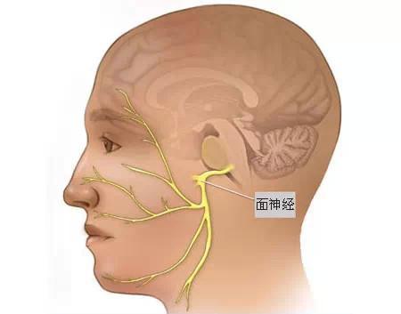 面肌痉挛患者面听神经长期受责任血管压迫有什么危害?