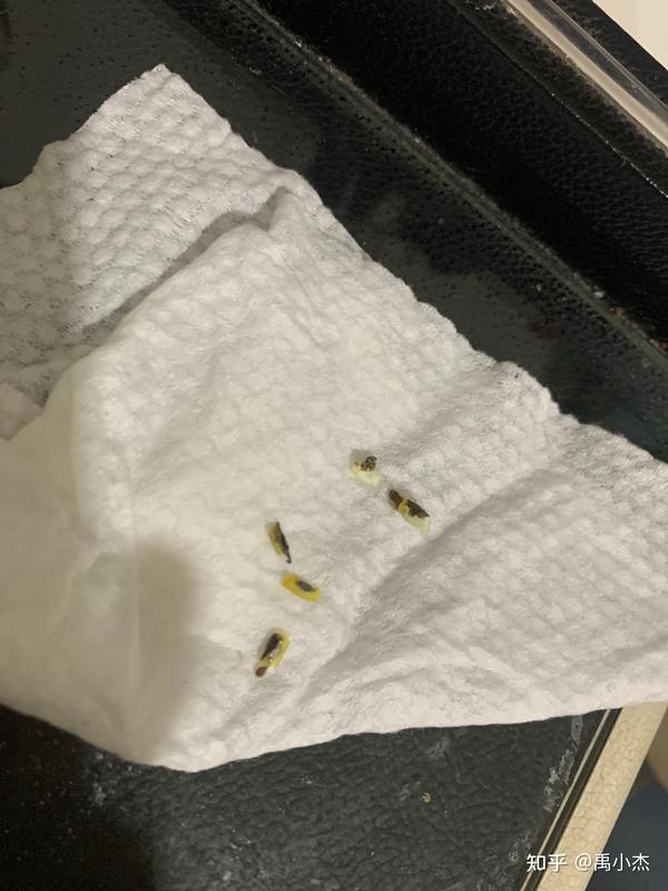 25岁割包皮第三天实录过程详细