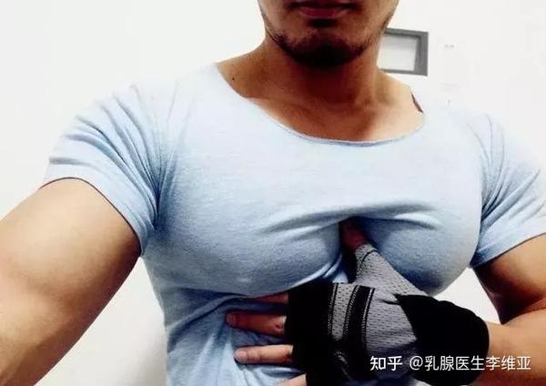 男孩乳房大因各种原因导致体内雌激素水平相对或绝对增高,乳腺上皮