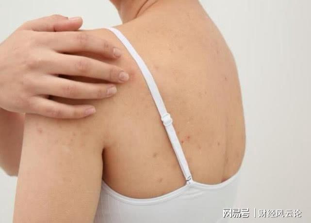 皮肤瘙痒需要做哪些检查?