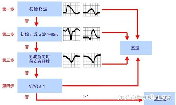 心电图诊断失误面面观