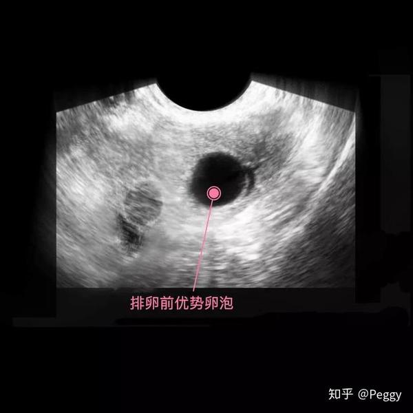 优势卵泡为孕育造就良好的环境.