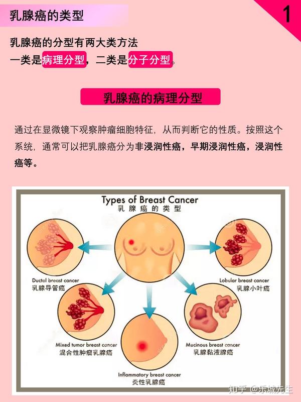 乳腺癌晚期实战生存知识(全图版)