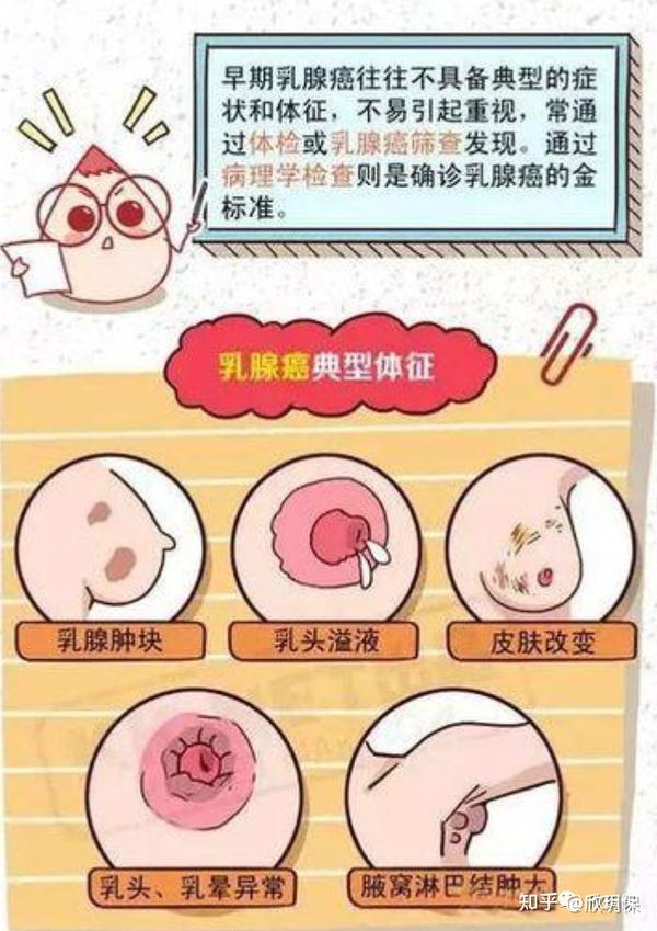 2 乳腺纤维腺瘤