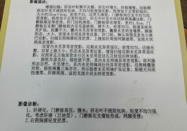 甲胎蛋白含量4万 ,慢性乙肝,肝硬化,巨块型达到了18公分占全了,无法