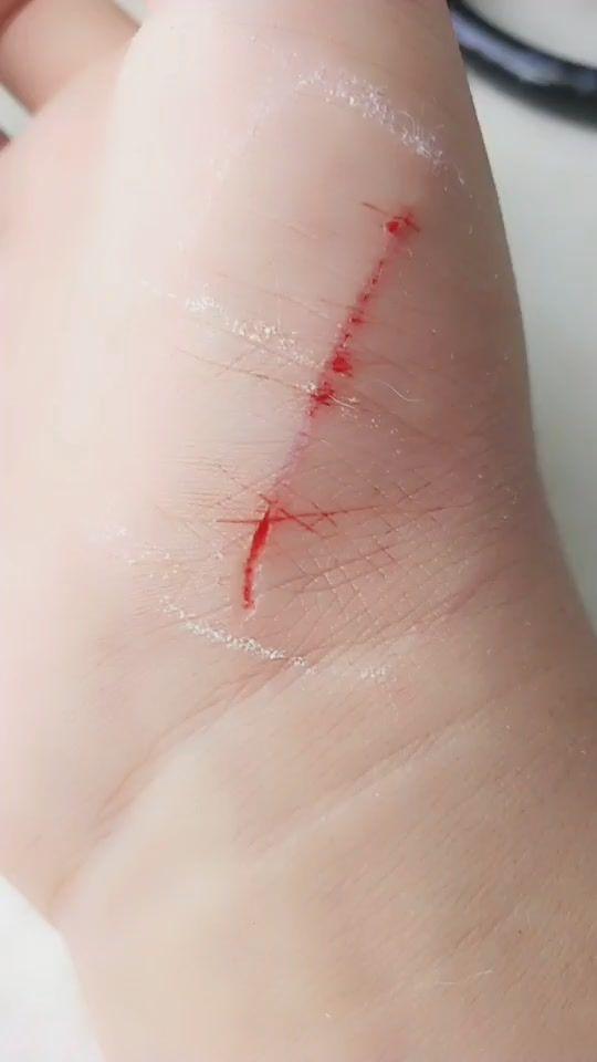 我的手被划出血了.