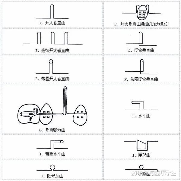 口腔正畸常用的各种矫治弹簧曲应用