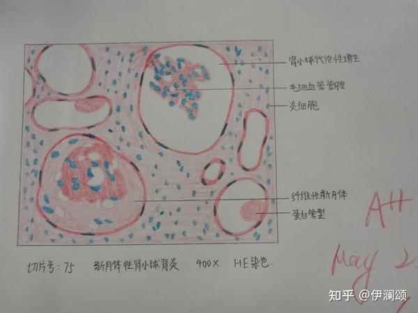 病理实验红蓝铅笔绘图