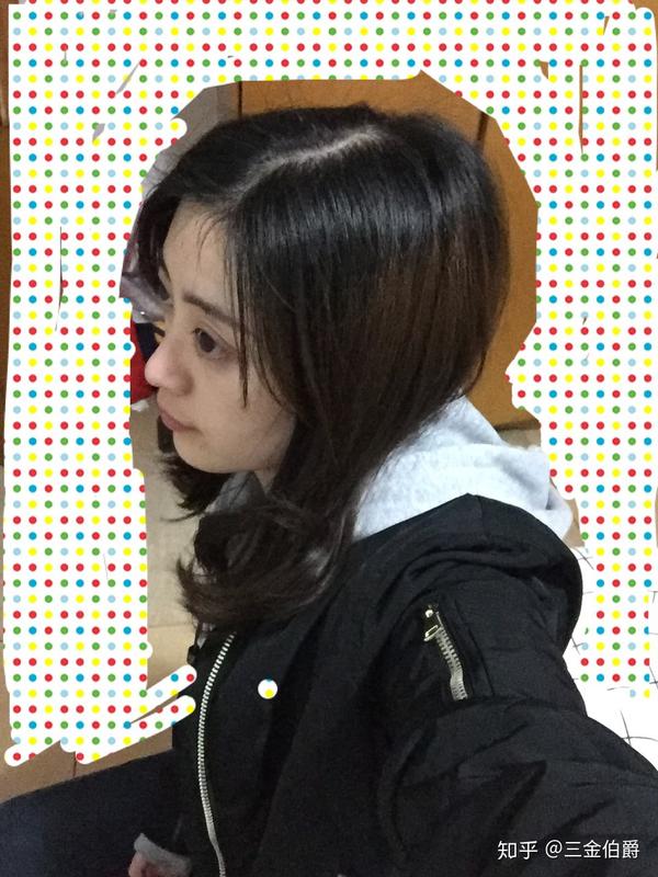 侧面看眼睛非常突,眉骨低和鼻子连接不起来是怎么回事?
