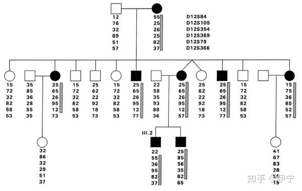 努南综合征noonan的前世今生