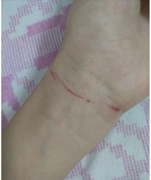 抑郁症患者的心理是怎样的?为什么有的会抑郁到自杀?
