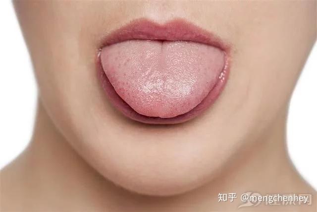 健康的舌头是什么样的?
