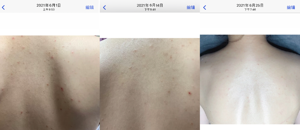 8款身体磨砂膏红榜盘点身体美白去鸡皮去关节黑净痘各大网红磨砂膏大