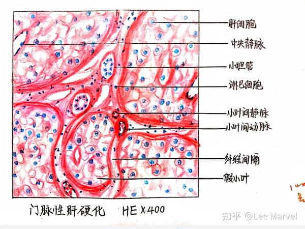 大学病理学红蓝铅笔绘图