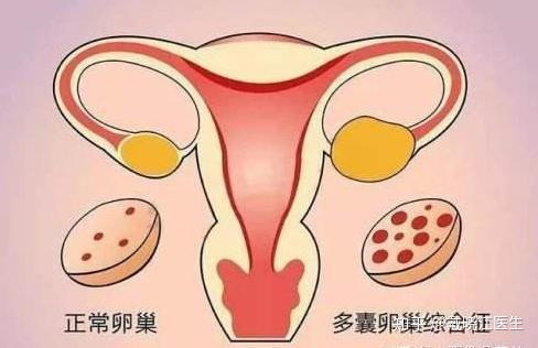 奇葩的吉尼斯纪录:英年轻女子满脸络腮胡 患有多囊性卵巢综合征