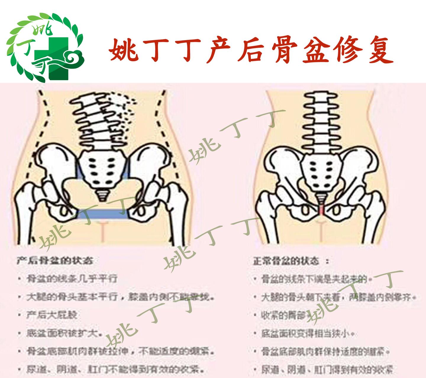 骨盆对女人来说有多重要