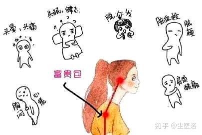 富贵包的消除和改善头前倾,通过运动和减肥可以吗?