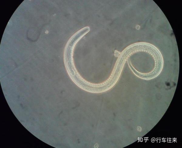 钩虫的危害性也不容小觑.