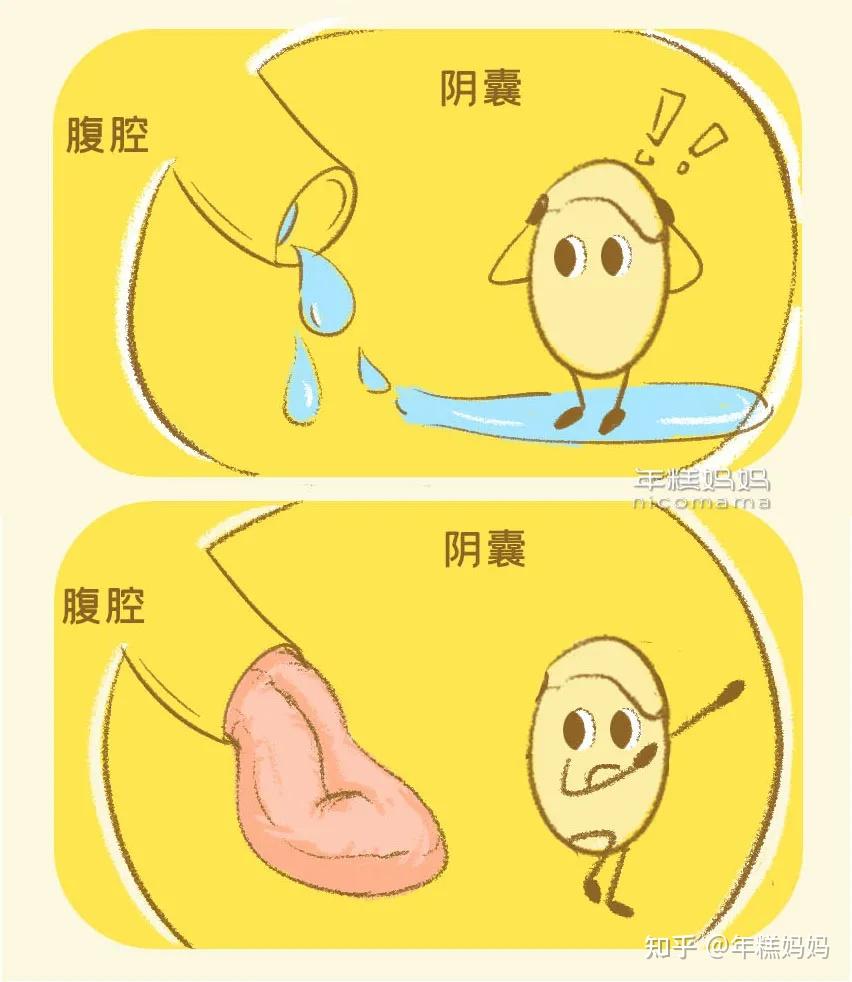 宝宝还小,大多数时候,小鸡鸡看不到头只是"生理性包茎",属于正常情况.