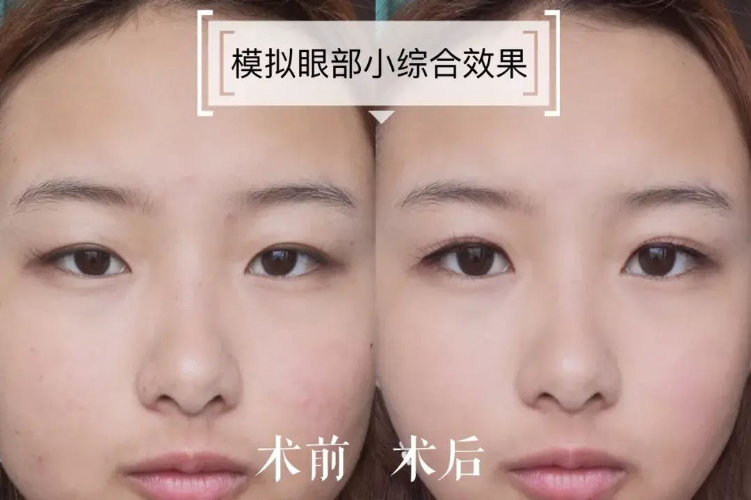 5~7mm,开扇型平扇型皆可(平时素颜多一点选开扇,化妆多一点选平扇),双