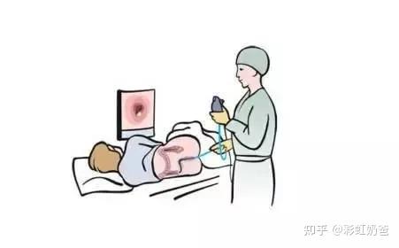 灌肠会增加hiv感染风险吗?丨彩虹奶爸
