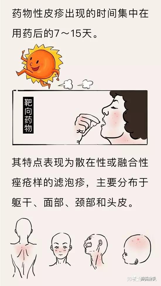 80%的患者吃靶向药出现皮疹,怎么回事?