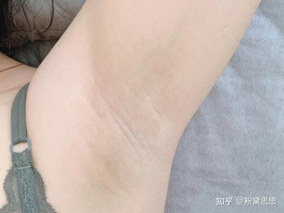 有狐臭的女生胸部和体下都有味道怎么办?