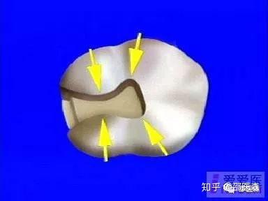 口腔规培考试重点(本人整理得巨细)