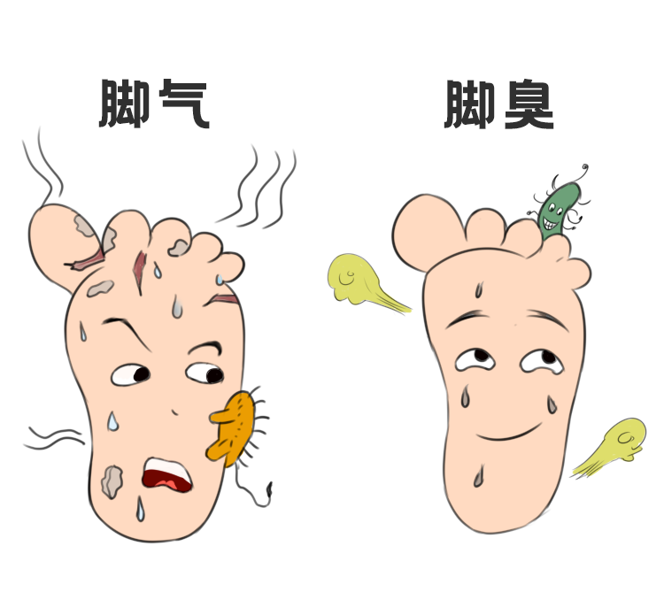 治疗预防脚气的小偏方