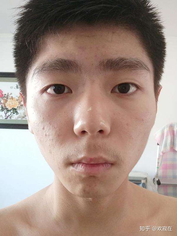 五官好看,皮肤差是什么体验?