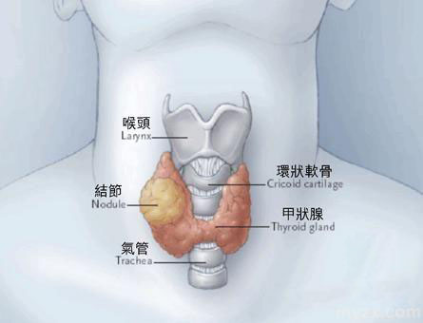 得了甲状腺炎不在意小心引发各种并发症威胁患者健康