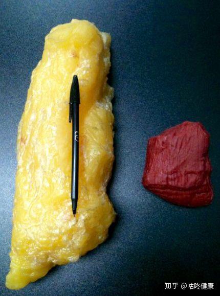 一张非常经典的对比图: 5磅脂肪和5磅肌肉,同样的重量,脂肪看起