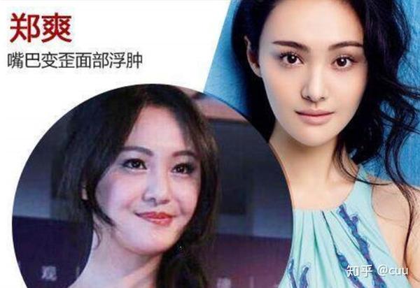 不用整容也能变美,这位女明星说漏嘴,使用"它"后年轻了10岁