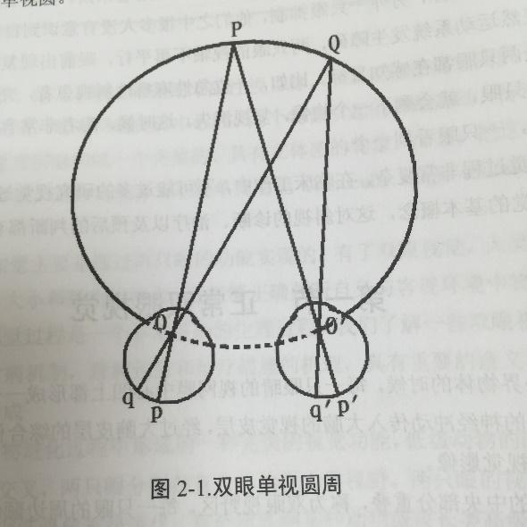 双眼视差大,看东西时会产生双像,这正常吗?