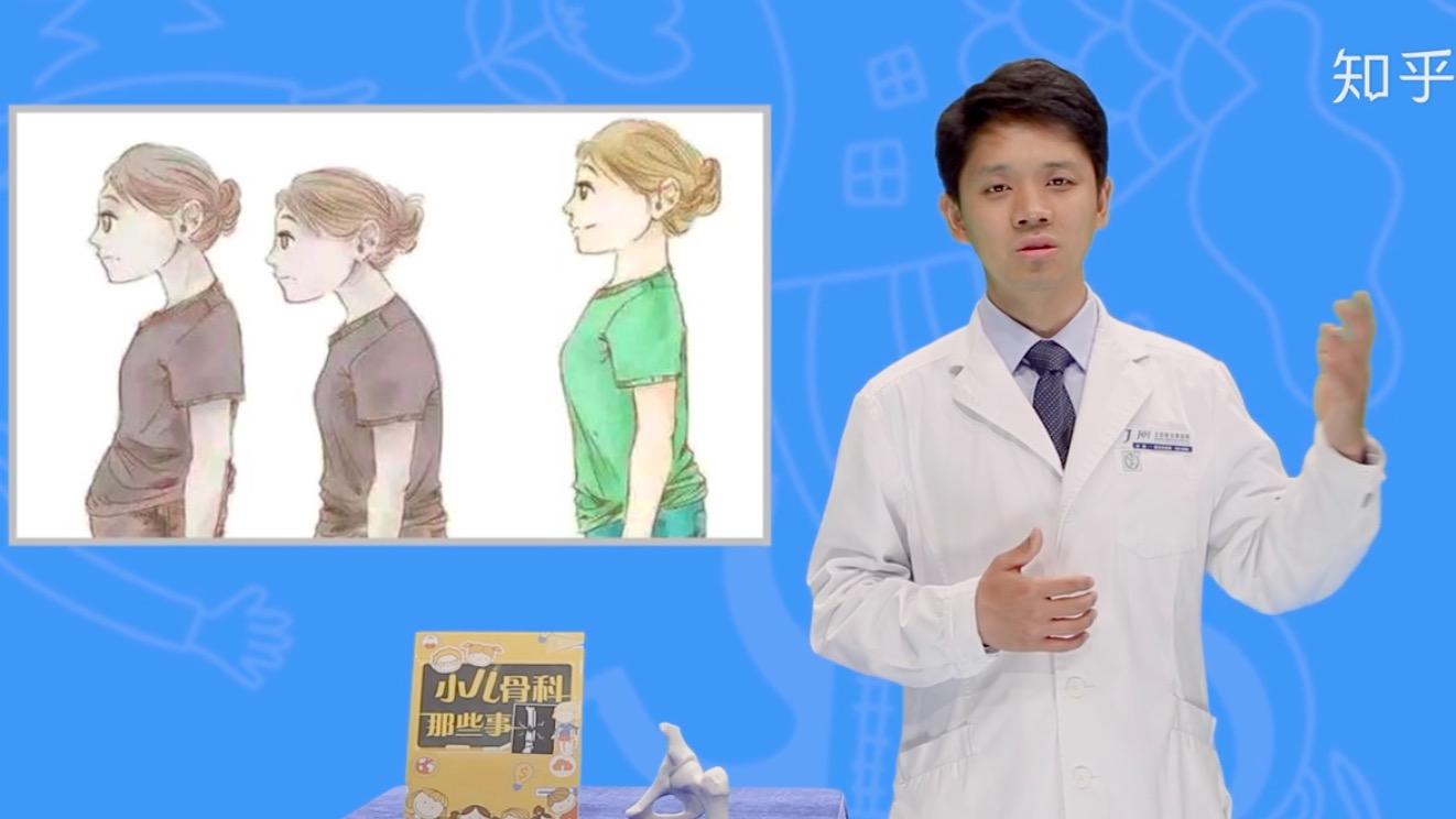 儿童驼背系统矫正?