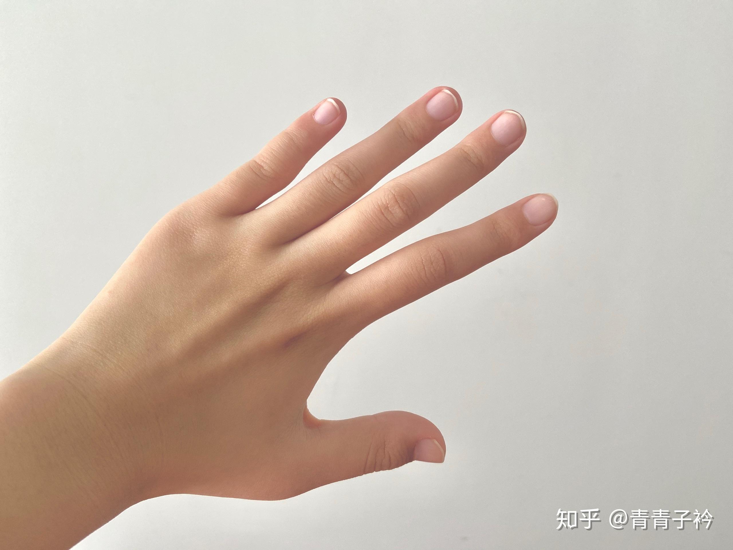 为什么我的大拇指又宽又短