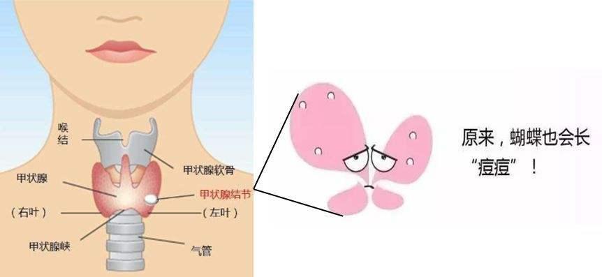 甲状腺功能到底查五项还是七项