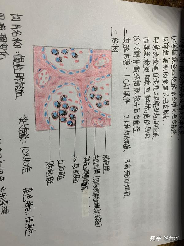 病理学红蓝铅笔画图