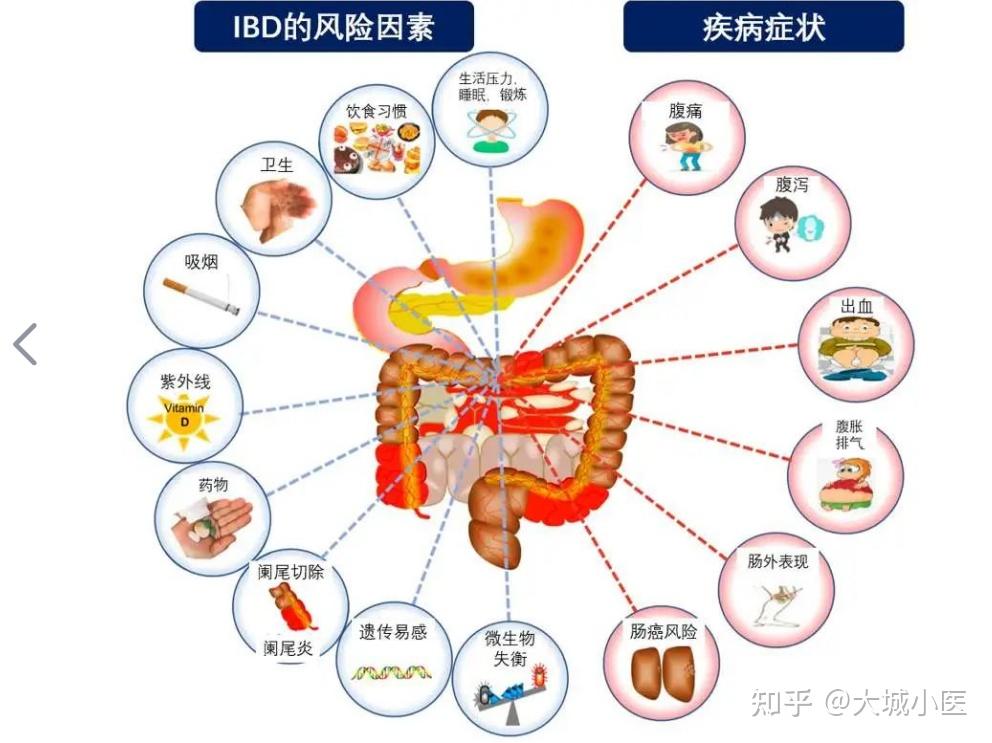 1周瘦6斤是好事吗腹泻腹痛都要警惕起来小心克罗恩病