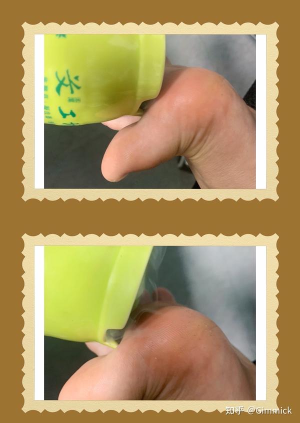 找到"痴呆线"!温通预防老年痴呆!