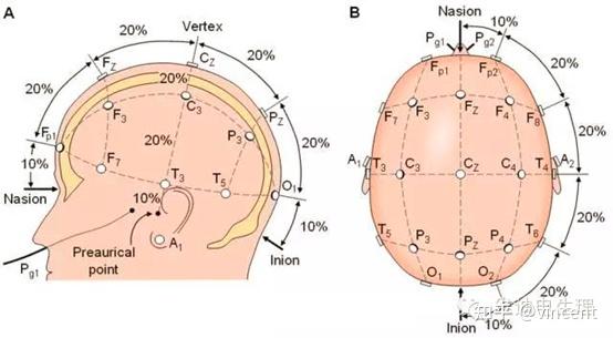 监测脑活动的eeg: 一般患者脑电图电极位置采用10~20国际命名法(如下