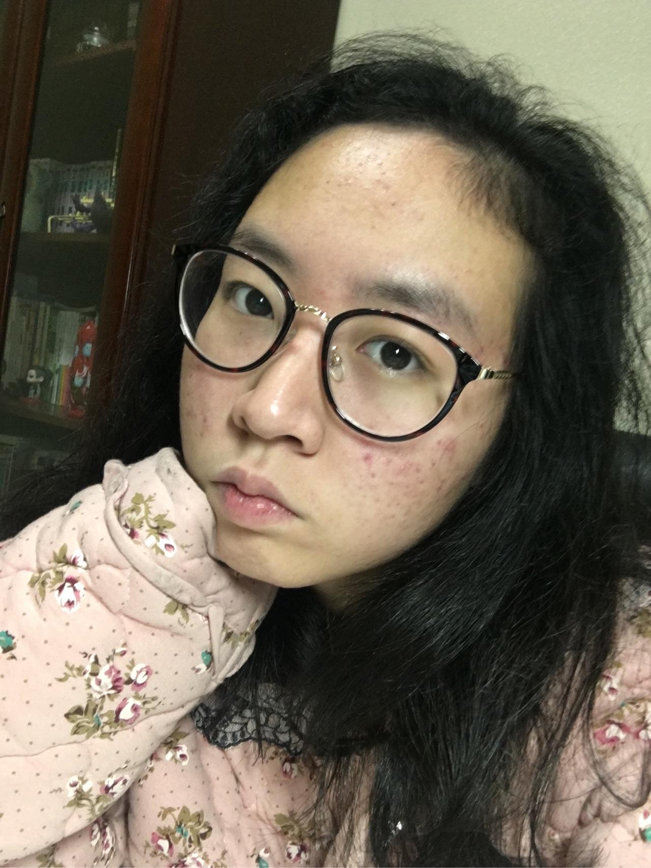 五官再漂亮的女生是不是长了一脸痘都被嫌弃女生a五官图片动画图片