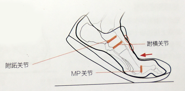适度地抑制跗横关节和跗跖关节运动,可以抑制足弓的过渡扩张.