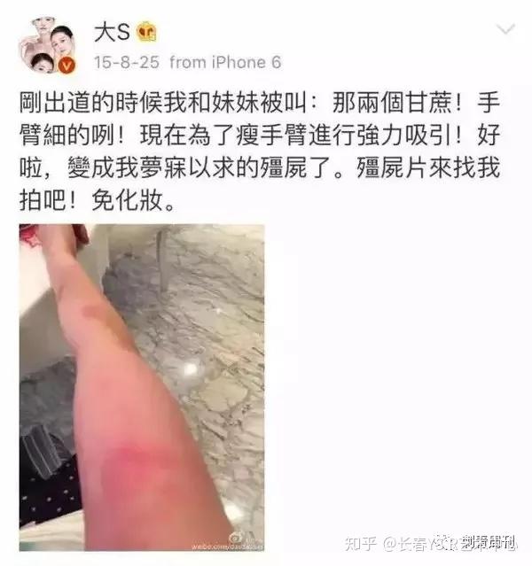 图案(常言道"纹身在虎口,社会路难走") 第二个是脖子后的六芒星图案