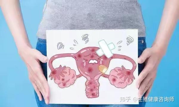 输卵管堵塞有什么症状吗?