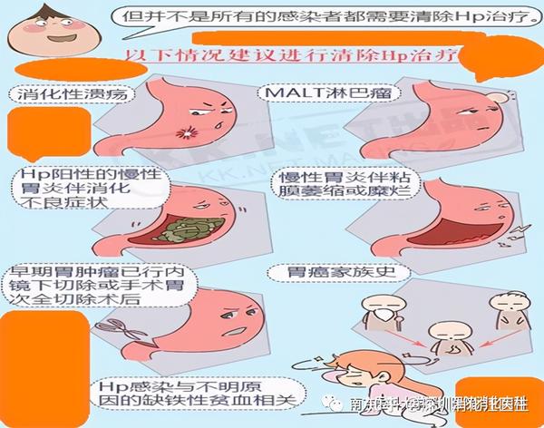 以下人群需要根治幽门螺旋杆菌