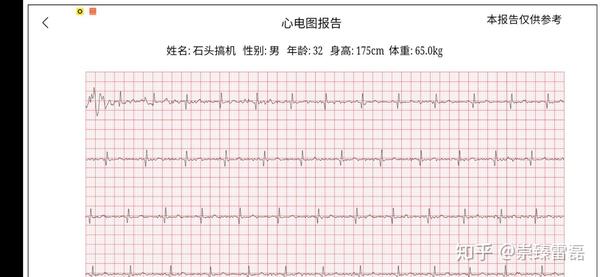 米家运动心电t恤体验!运动神器实时监测心率